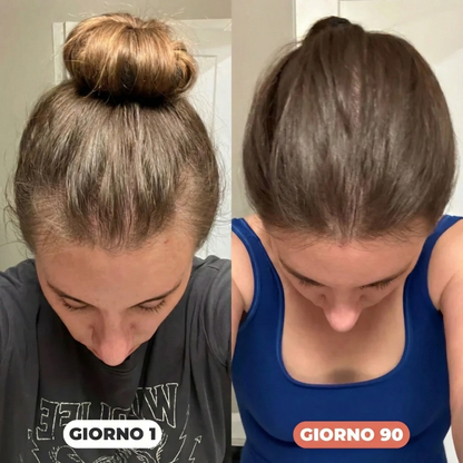 Nutrigen - Integratore per la crescita dei capelli